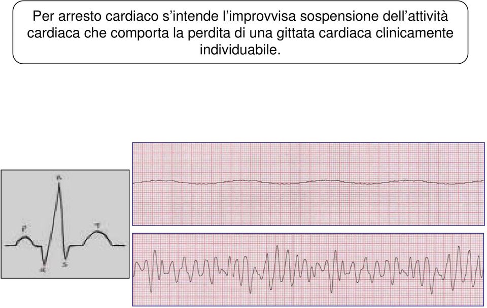 cardiaca che comporta la perdita di