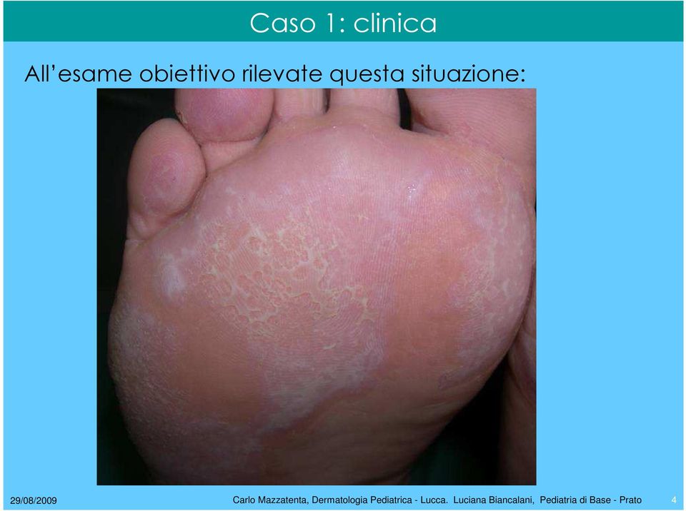 Carlo Mazzatenta, Dermatologia Pediatrica -