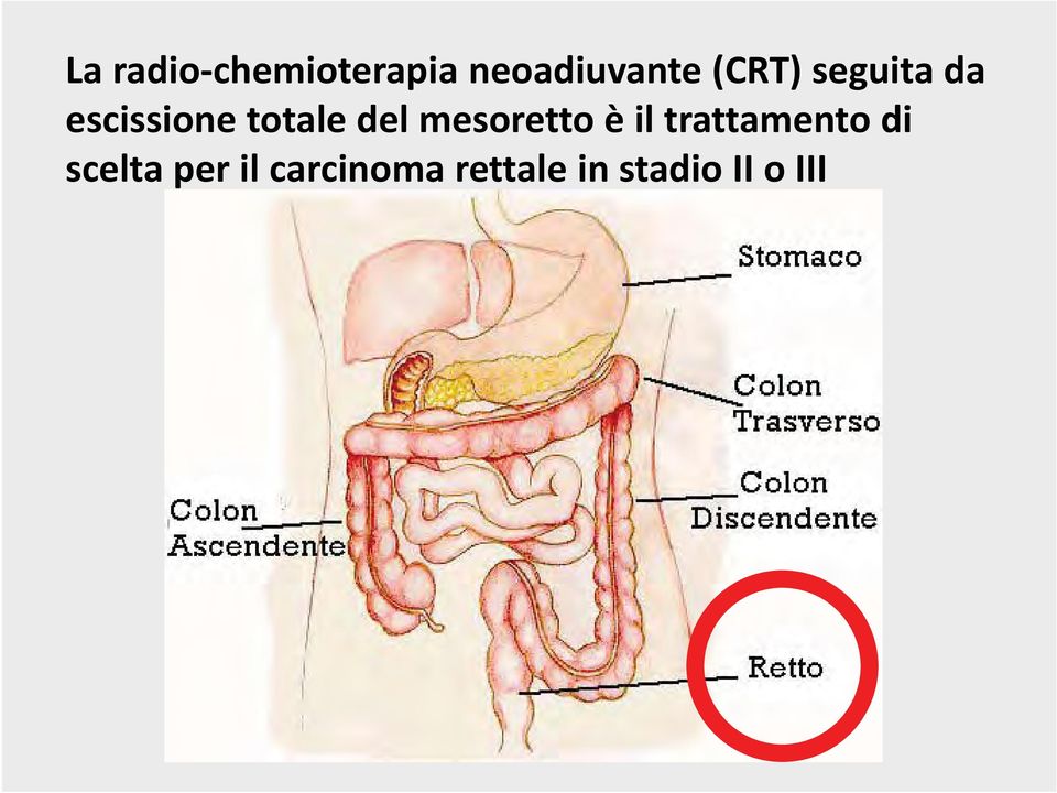 mesoretto è il trattamento di scelta