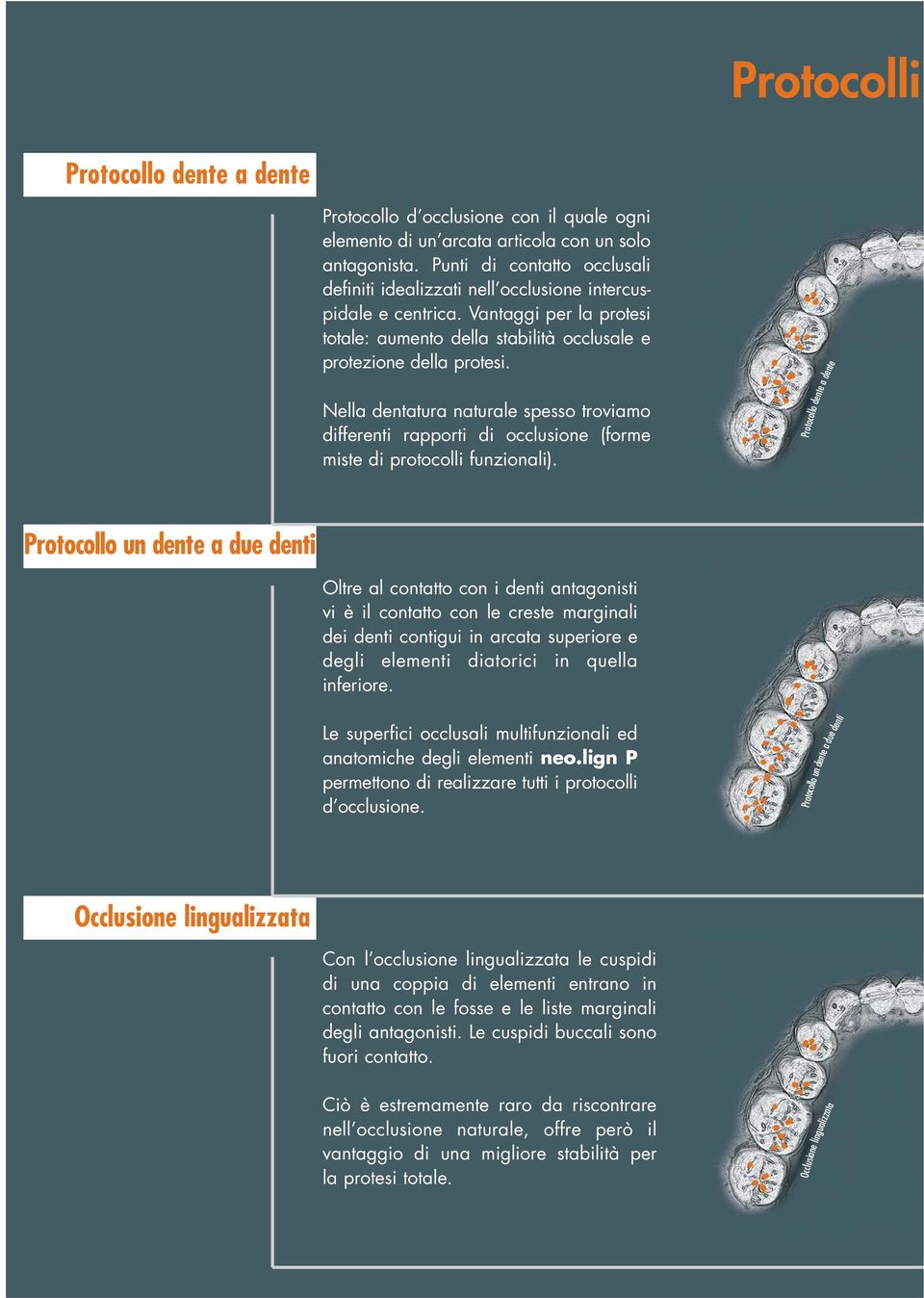 Nella dentatura naturale spesso troviamo differenti rapporti di occlusione (forme miste di protocolli funzionali).