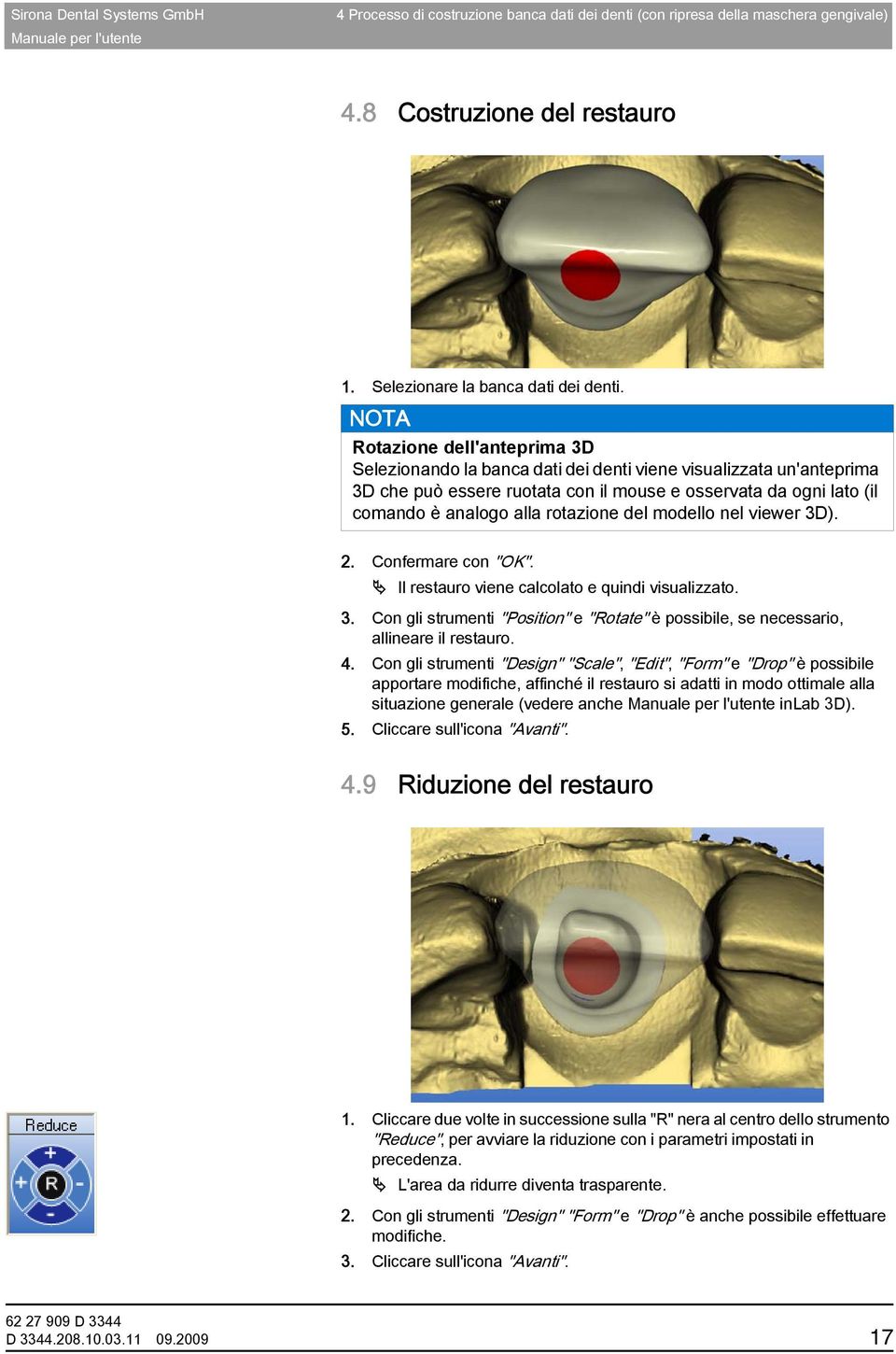 del modello nel viewer 3D). 2. Confermare con "OK". Il restauro viene calcolato e quindi visualizzato. 3. Con gli strumenti "Position" e "Rotate" è possibile, se necessario, allineare il restauro. 4.