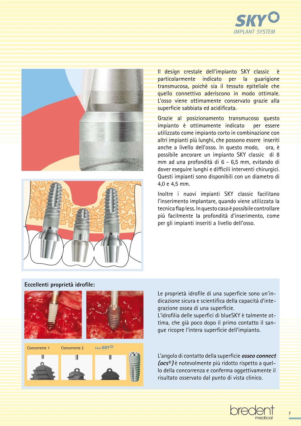 Grazie al posizionamento transmucoso questo impianto è ottimamente indicato per essere utilizzato come impianto corto in combinazione con altri impianti più lunghi, che possono essere inseriti anche