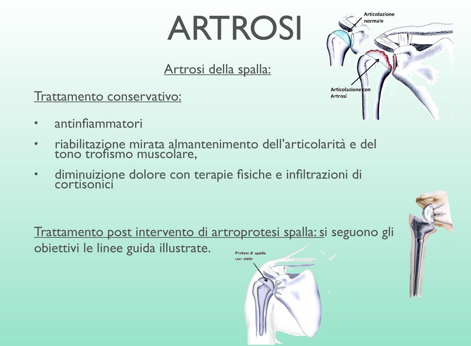 muscolare, diminuizione dolore con terapie fisiche e infiltrazioni di cortisonici