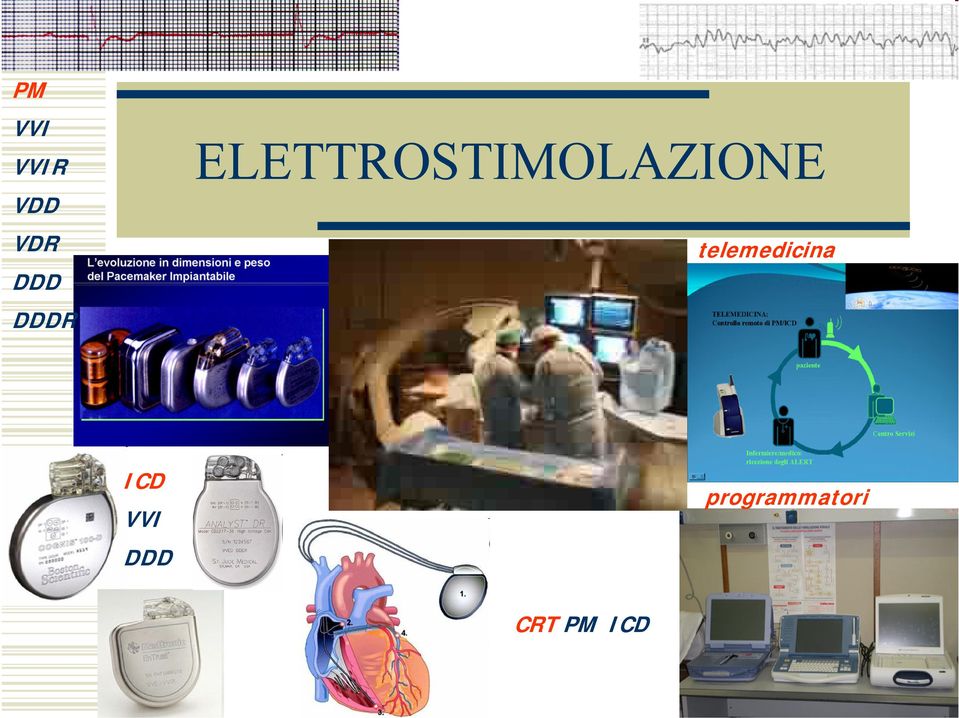 telemedicina ICD VVI DDD