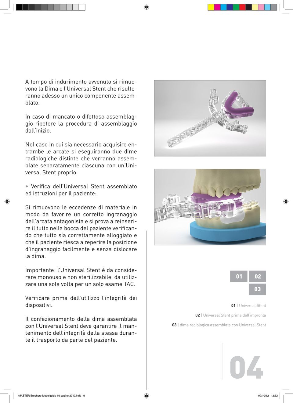 Nel caso in cui sia necessario acquisire entrambe le arcate si eseguiranno due dime radiologiche distinte che verranno assemblate separatamente ciascuna con un Universal Stent proprio.