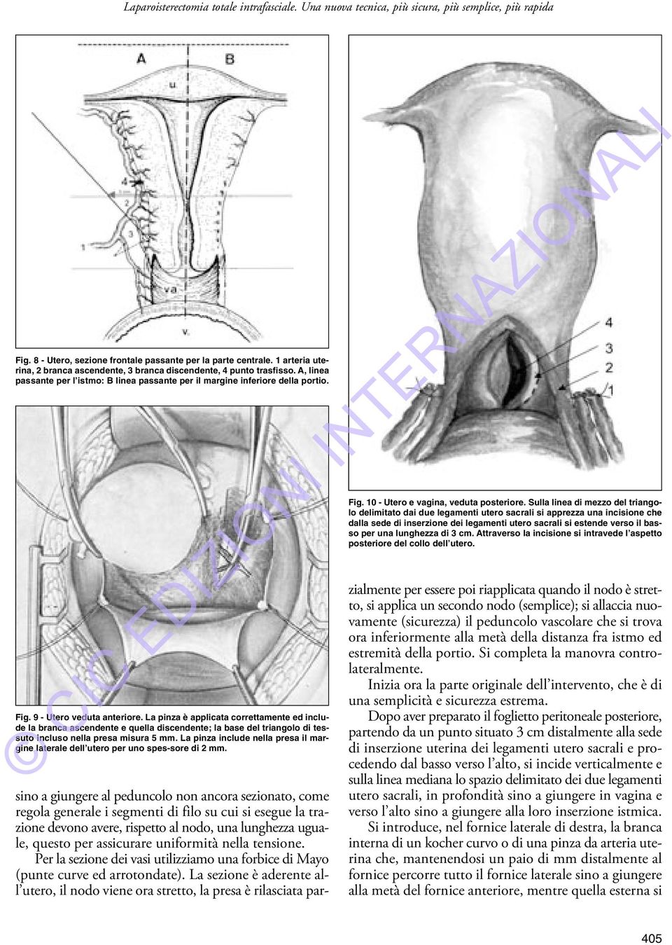 10 - Utero e vagina, veduta posteriore.