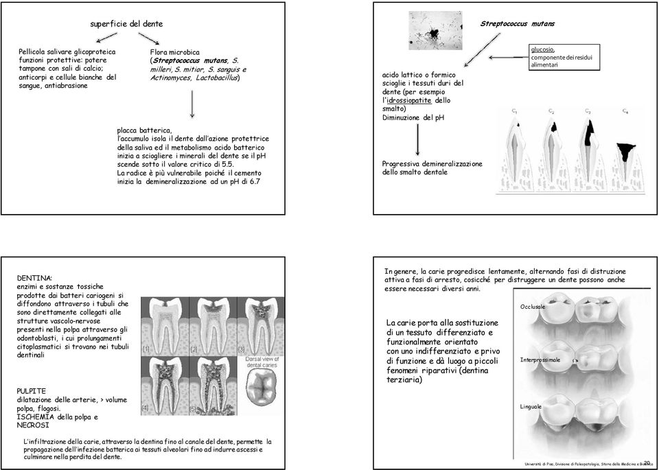 sanguis e Actinomyces, Lactobacillus) placca batterica, l accumulo isola il dente dall azione protettrice della saliva ed il metabolismo acido batterico inizia a sciogliere i minerali del dente se il