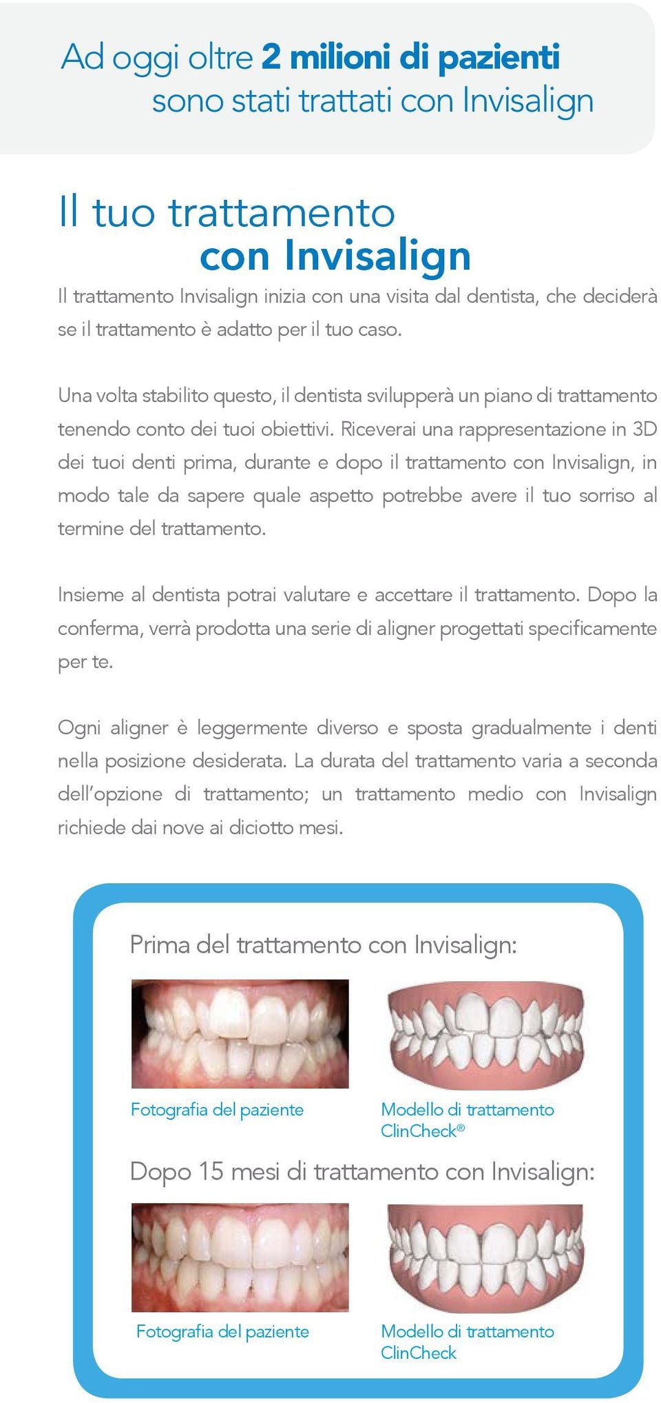 Riceverai una rappresentazione in 3D dei tuoi denti prima, durante e dopo il trattamento con Invisalign, in modo tale da sapere quale aspetto potrebbe avere il tuo sorriso al termine del trattamento.