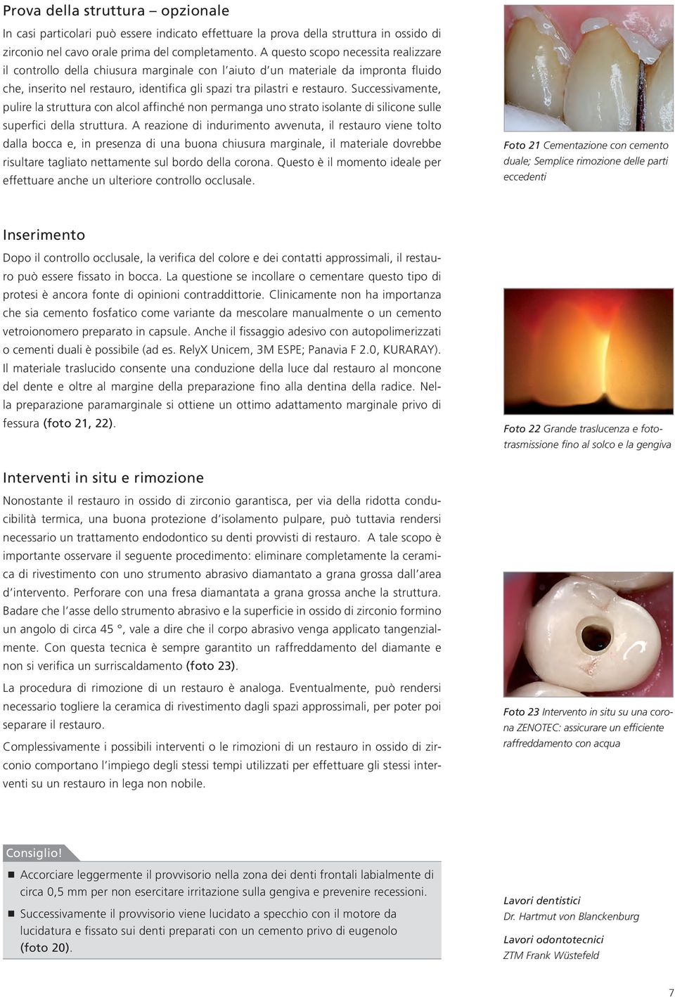 Successivamente, pulire la struttura con alcol affinché non permanga uno strato isolante di silicone sulle superfici della struttura.