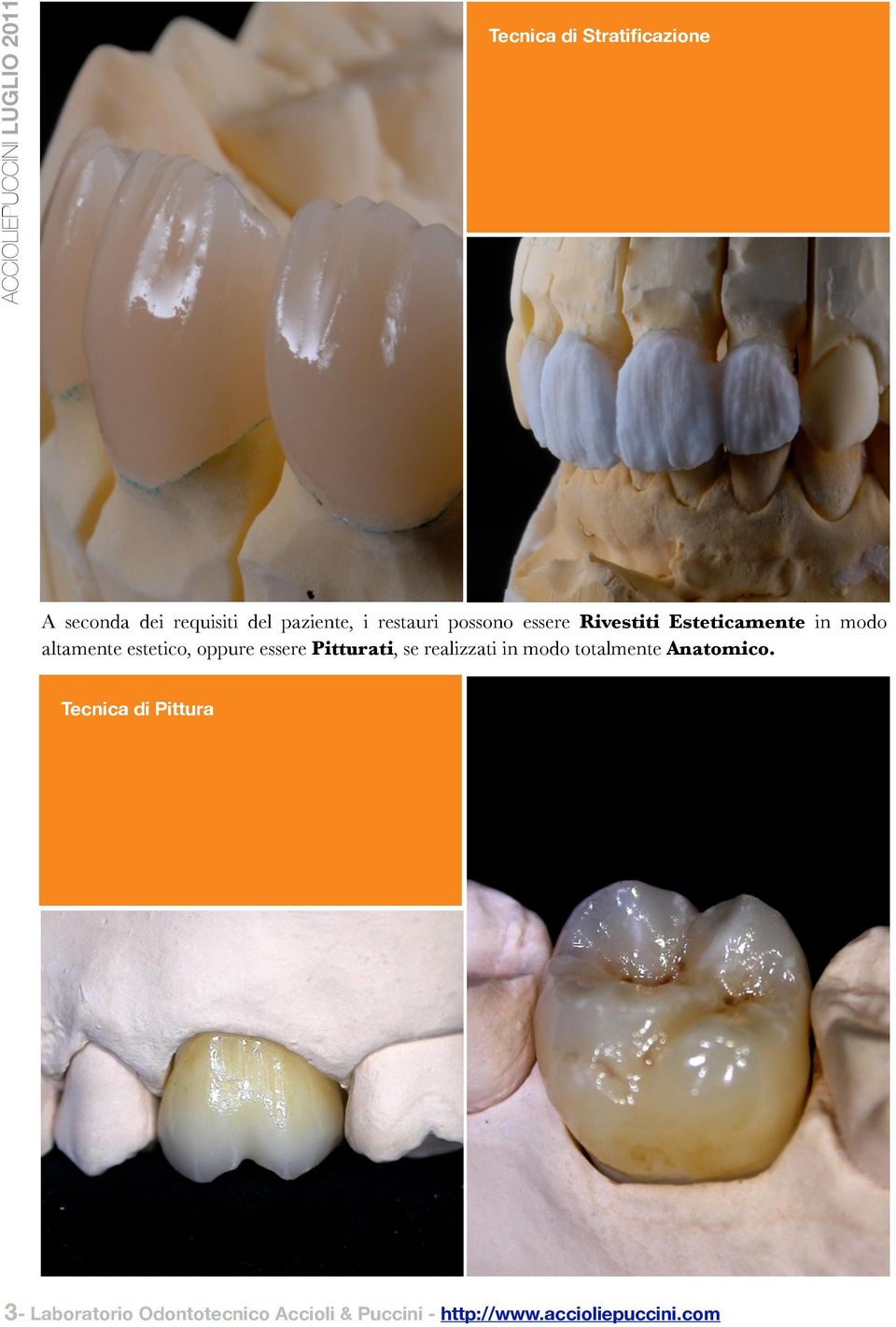 essere Pitturati, se realizzati in modo totalmente Anatomico.