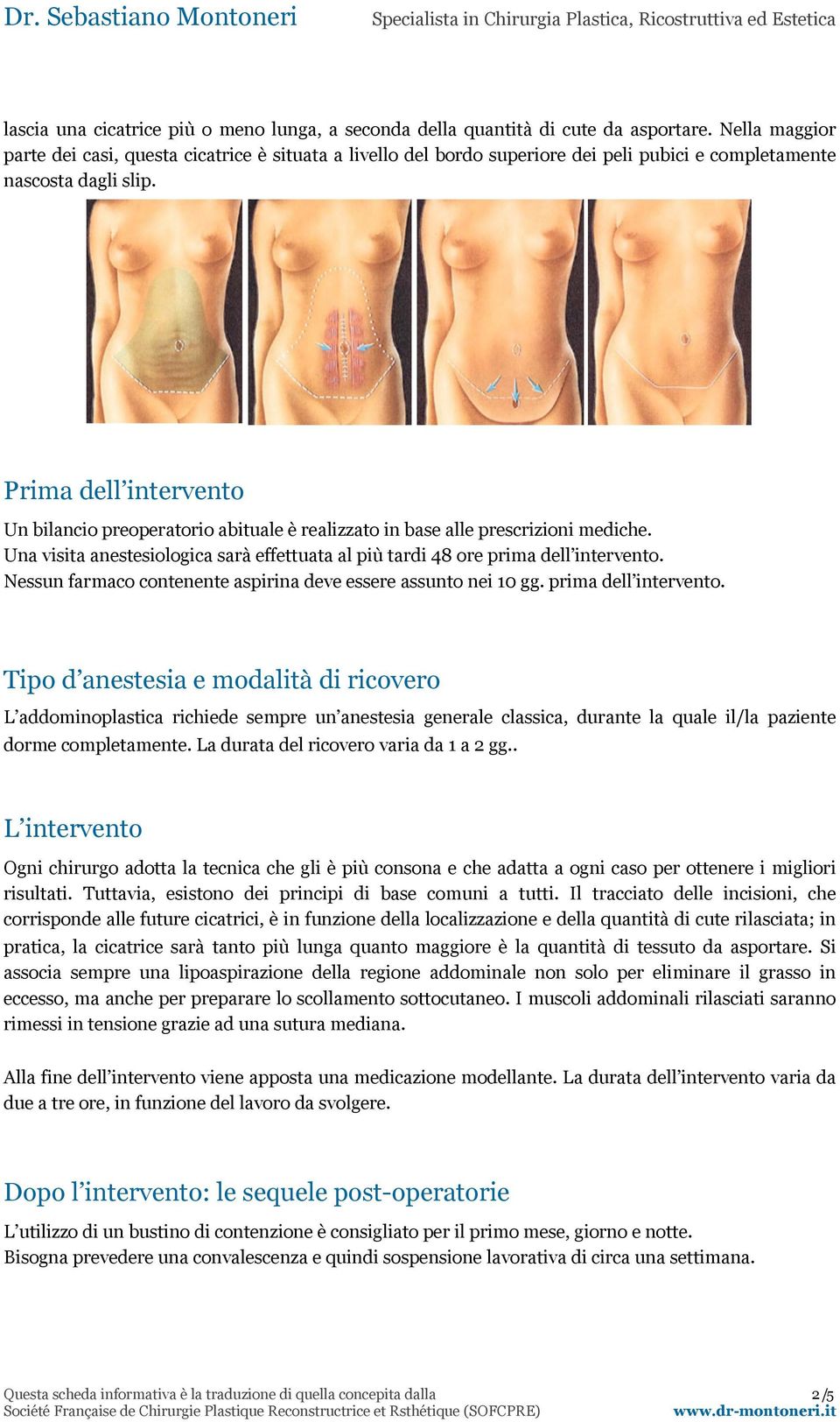 Prima dell intervento Un bilancio preoperatorio abituale è realizzato in base alle prescrizioni mediche. Una visita anestesiologica sarà effettuata al più tardi 48 ore prima dell intervento.