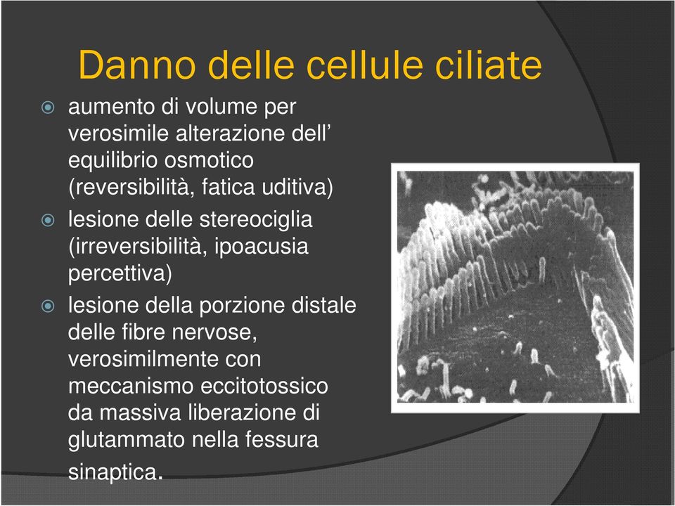 ipoacusia percettiva) lesione della porzione distale delle fibre nervose, verosimilmente