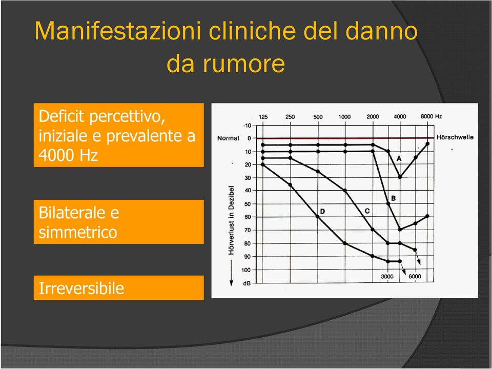 iniziale e prevalente a 4000 Hz