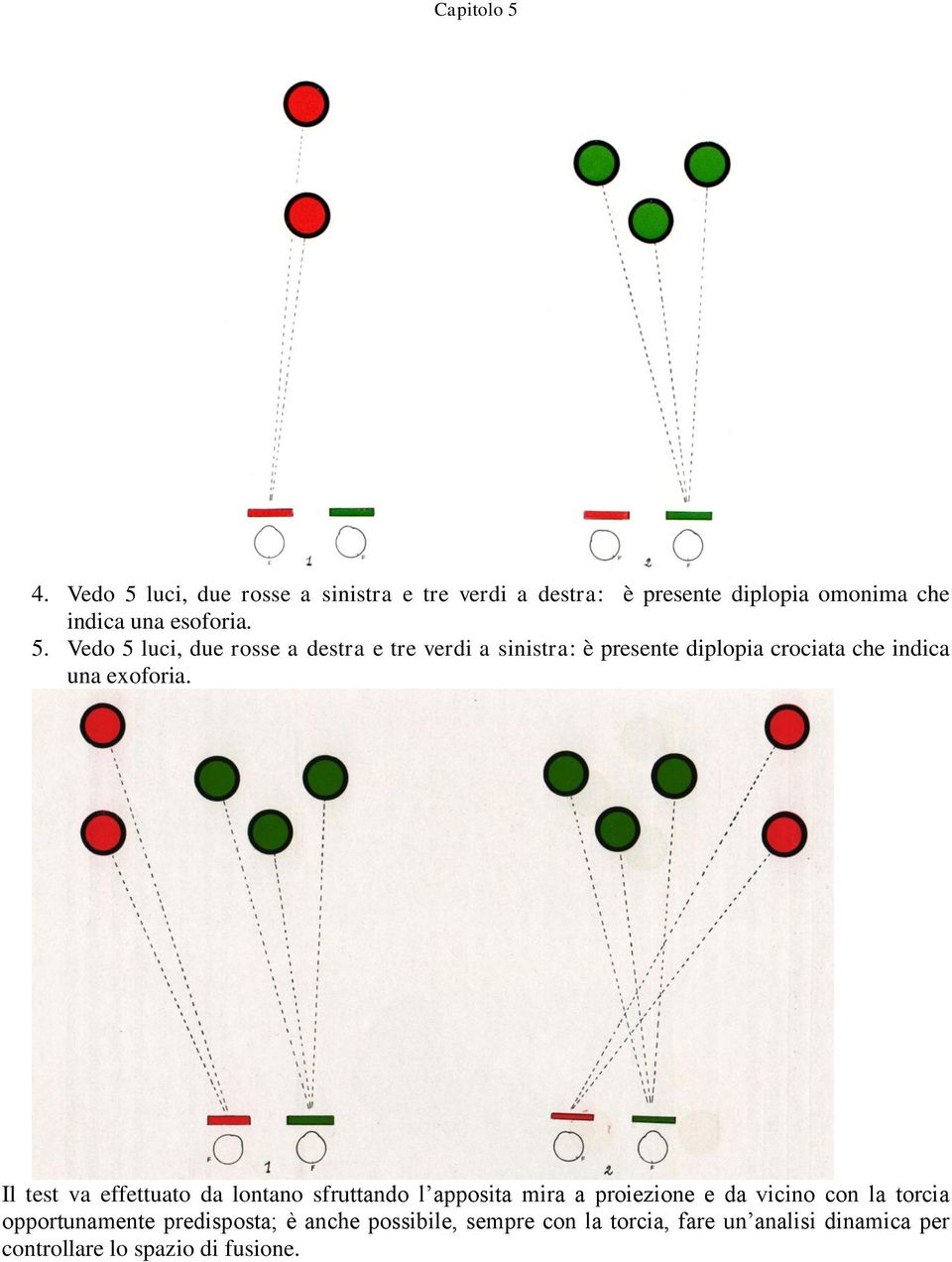 Vedo 5 luci, due rosse a destra e tre verdi a sinistra: è presente diplopia crociata che indica una exoforia.