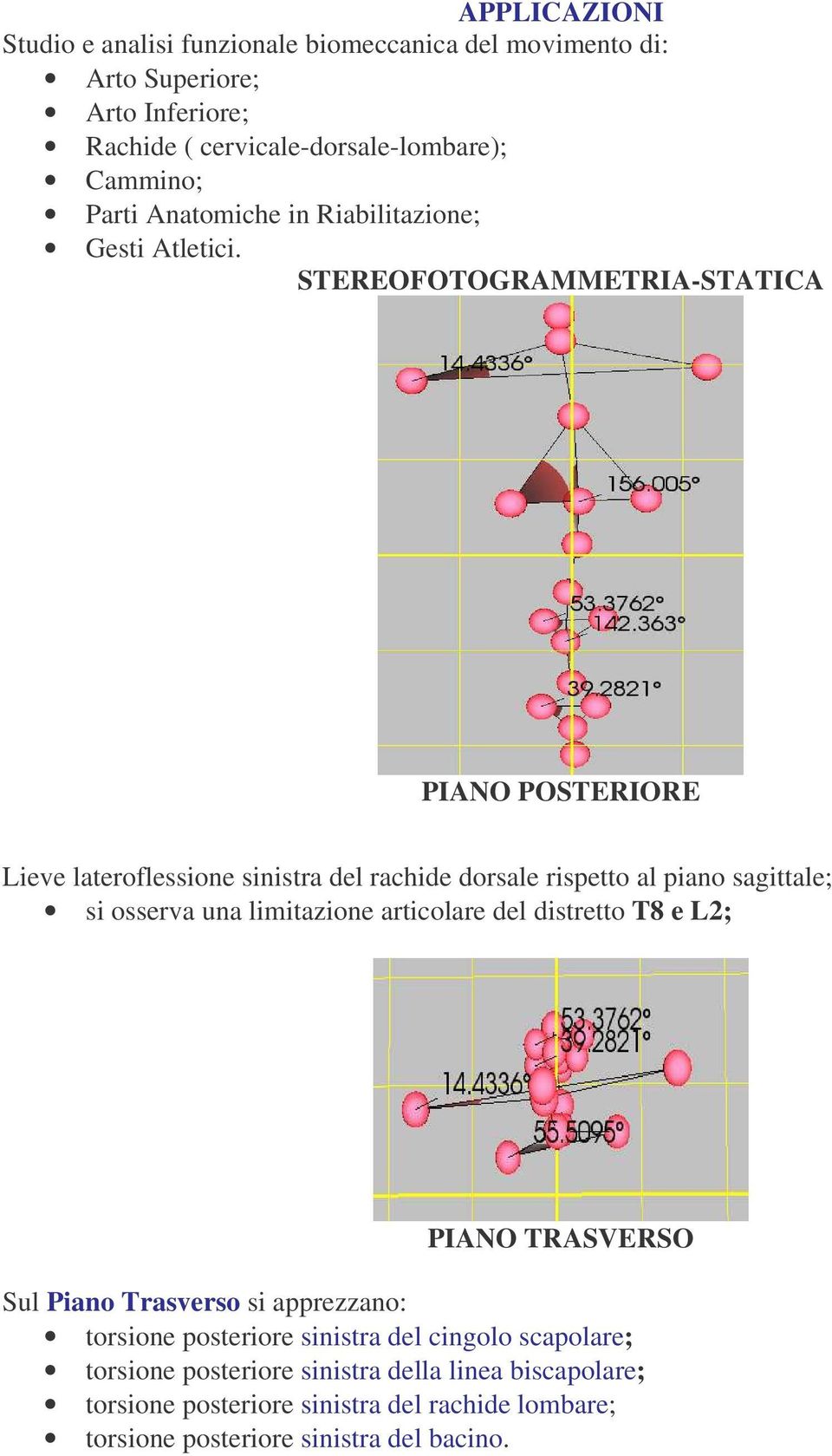 STEREOFOTOGRAMMETRIA-STATICA PIANO POSTERIORE Lieve lateroflessione sinistra del rachide dorsale rispetto al piano sagittale; si osserva una limitazione