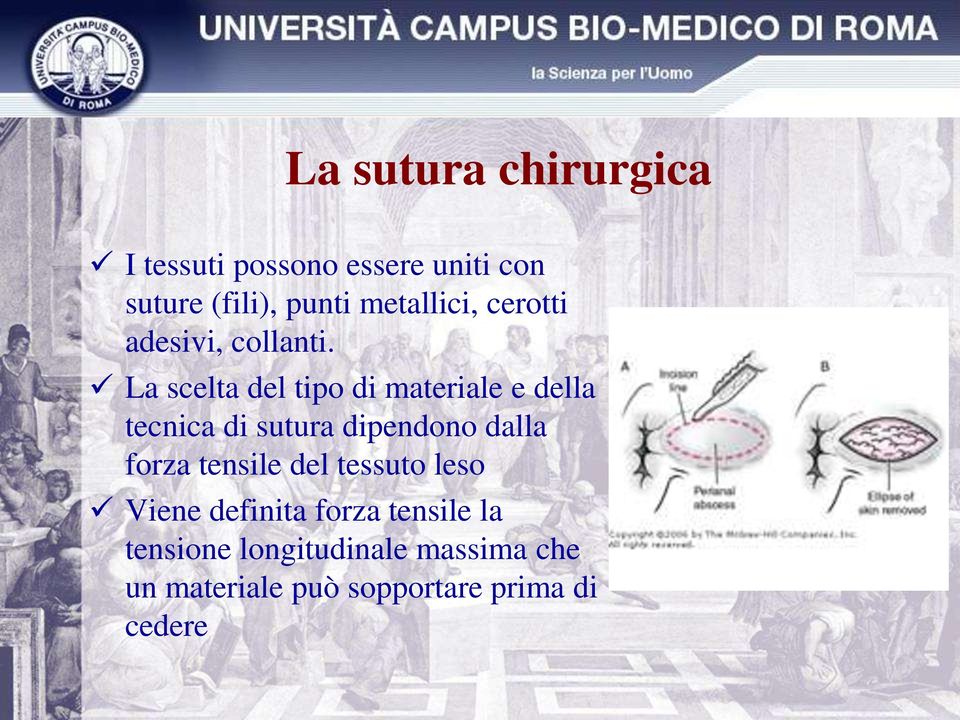 La scelta del tipo di materiale e della tecnica di sutura dipendono dalla forza