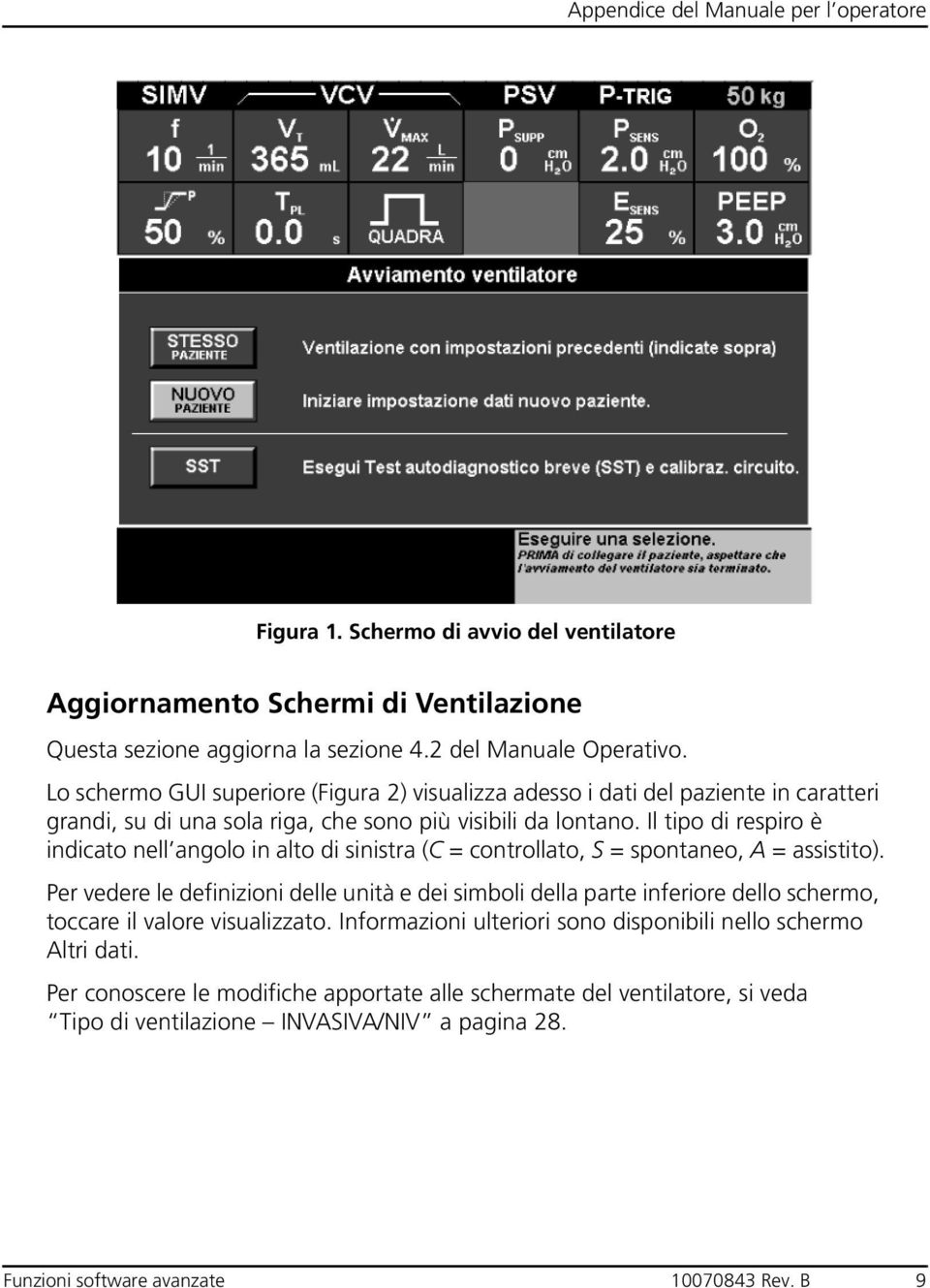 Il tipo di respiro è indicato nell angolo in alto di sinistra (C = controllato, S = spontaneo, A = assistito).