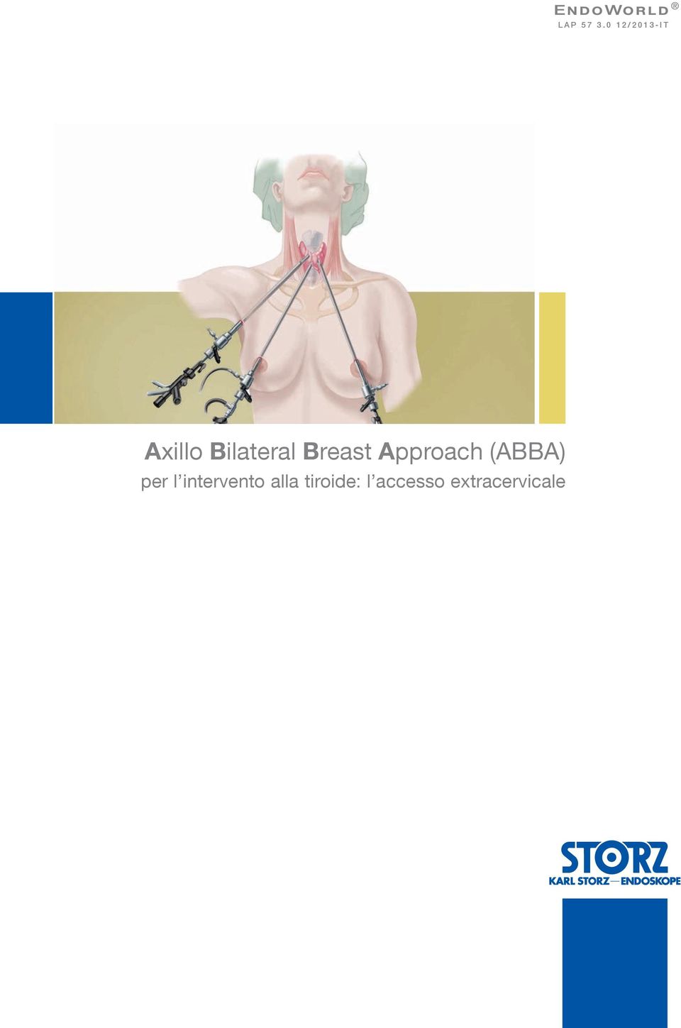 Breast Approach (ABBA) per l