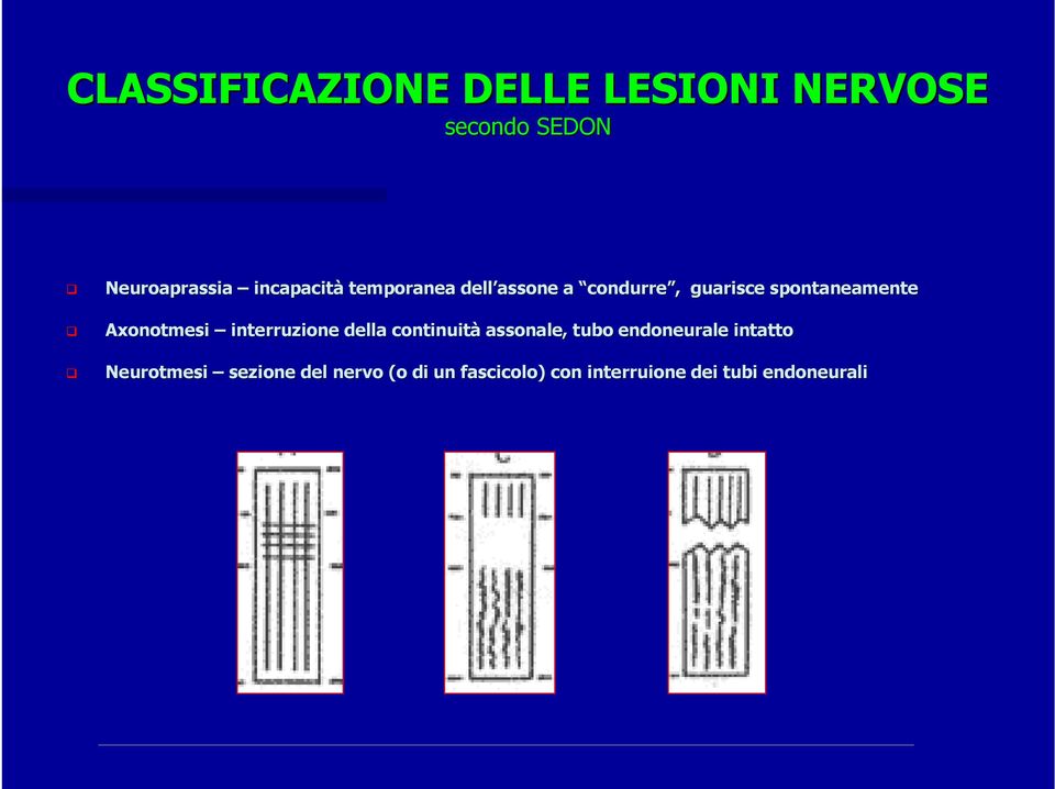 Axonotmesi interruzione della continuità assonale,, tubo endoneurale