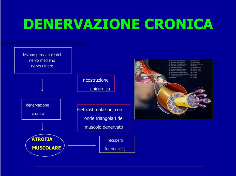 denervazione cronica Elettrostimolazioni con onde