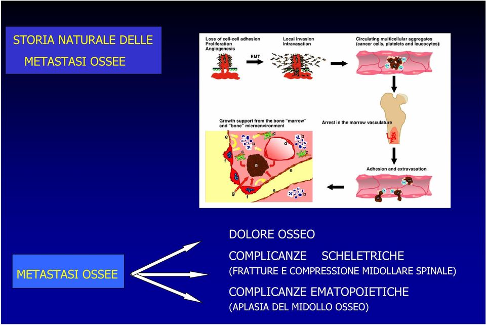 (FRATTURE E COMPRESSIONE MIDOLLARE SPINALE)