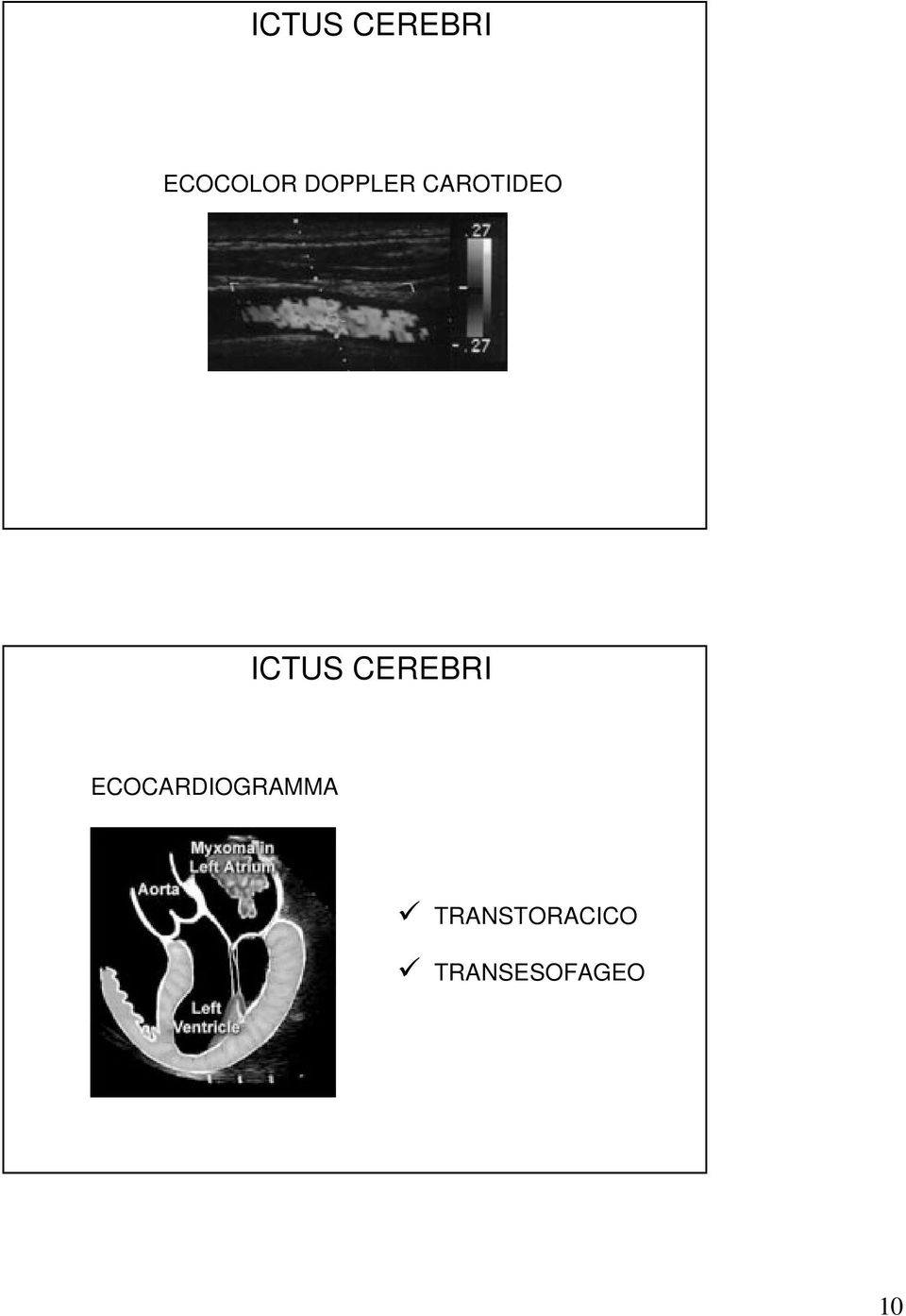 CEREBRI ECOCARDIOGRAMMA