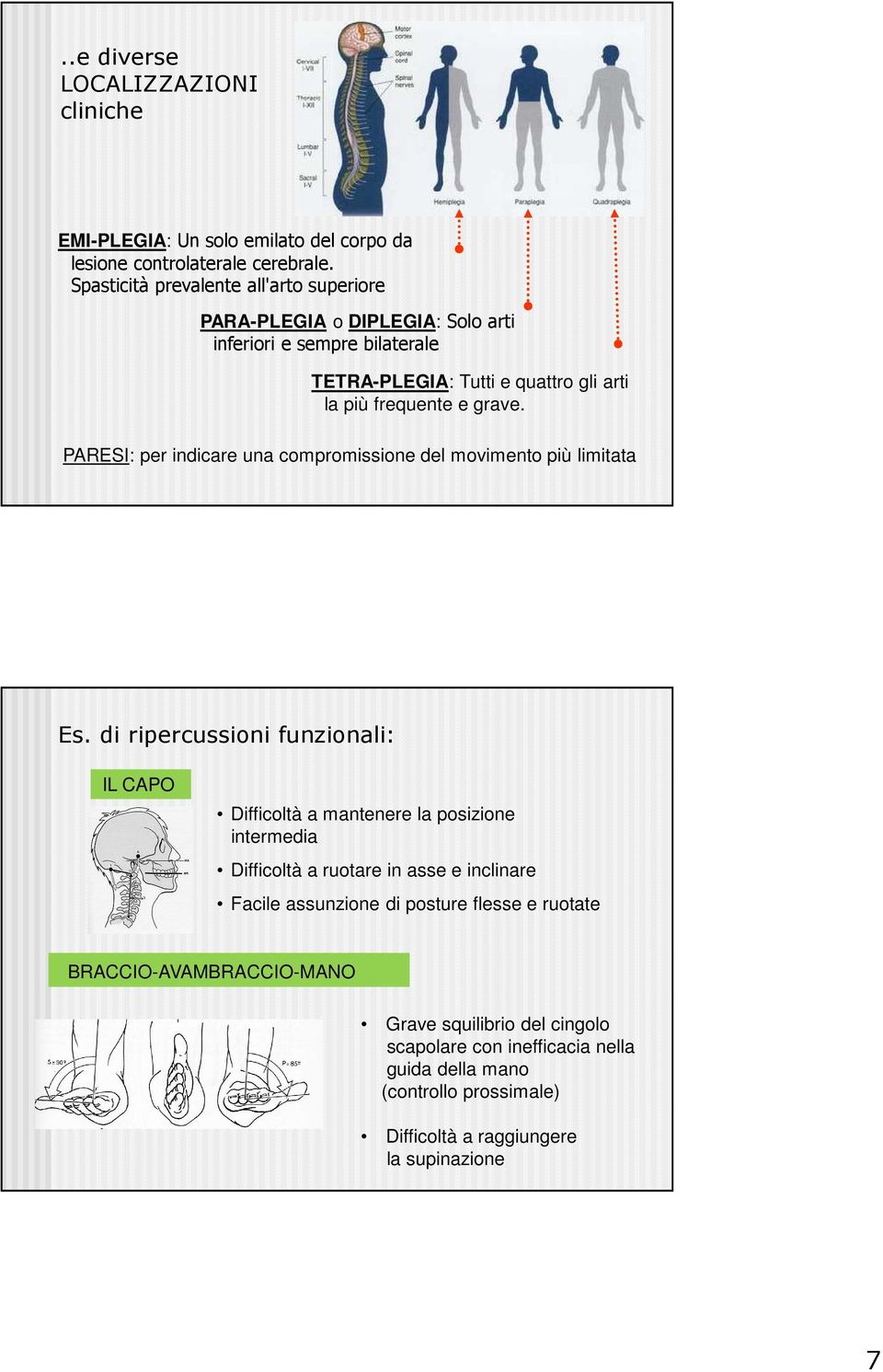 PARESI: per indicare una compromissione del movimento più limitata Es.