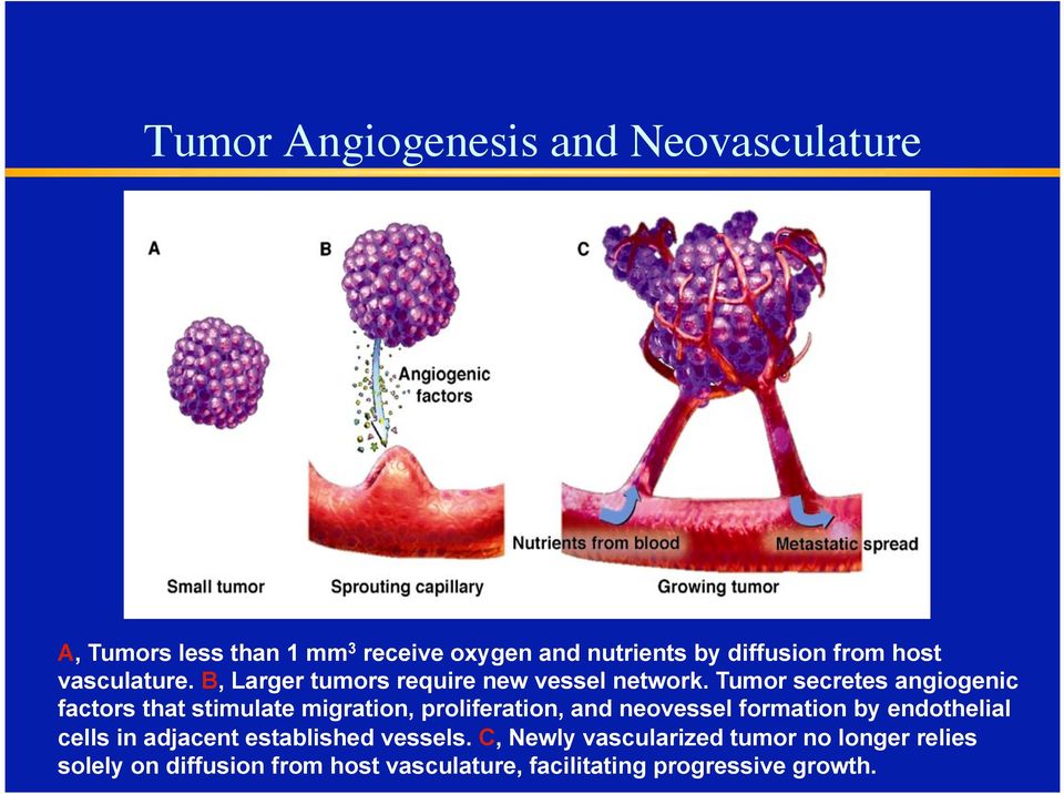 B, Larger tumors require new vessel network.