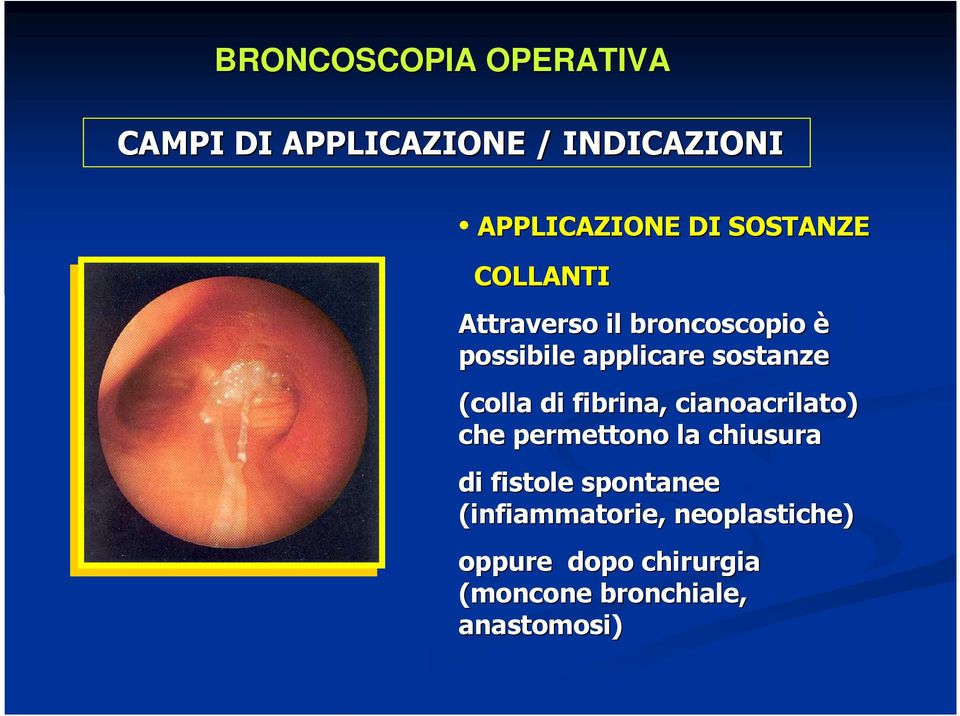 che permettono la chiusura di fistole spontanee (infiammatorie,