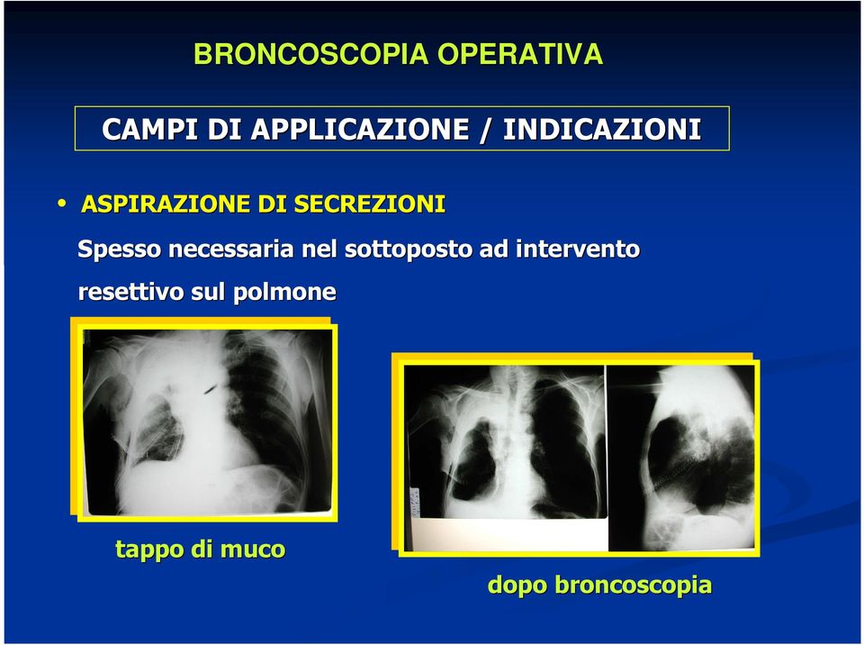 sottoposto ad intervento