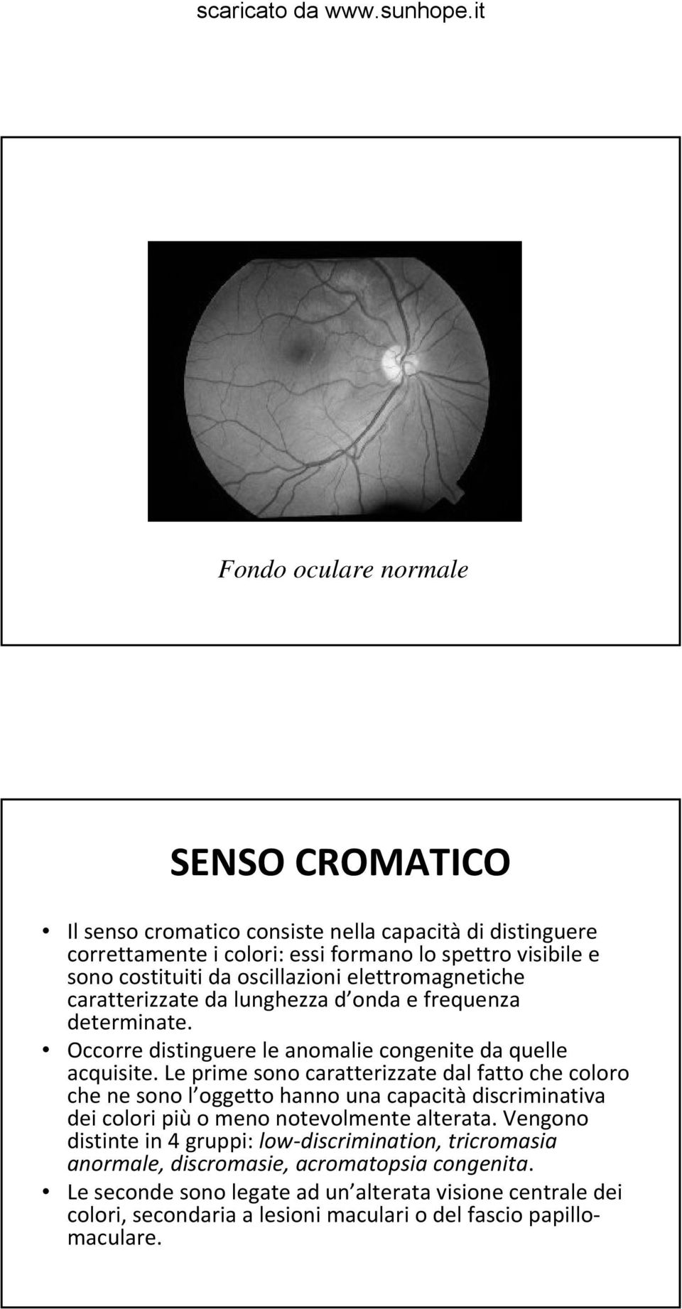 Le prime sono caratterizzate dal fatto che coloro che ne sono l oggetto hanno una capacità discriminativa dei colori più o meno notevolmente alterata.