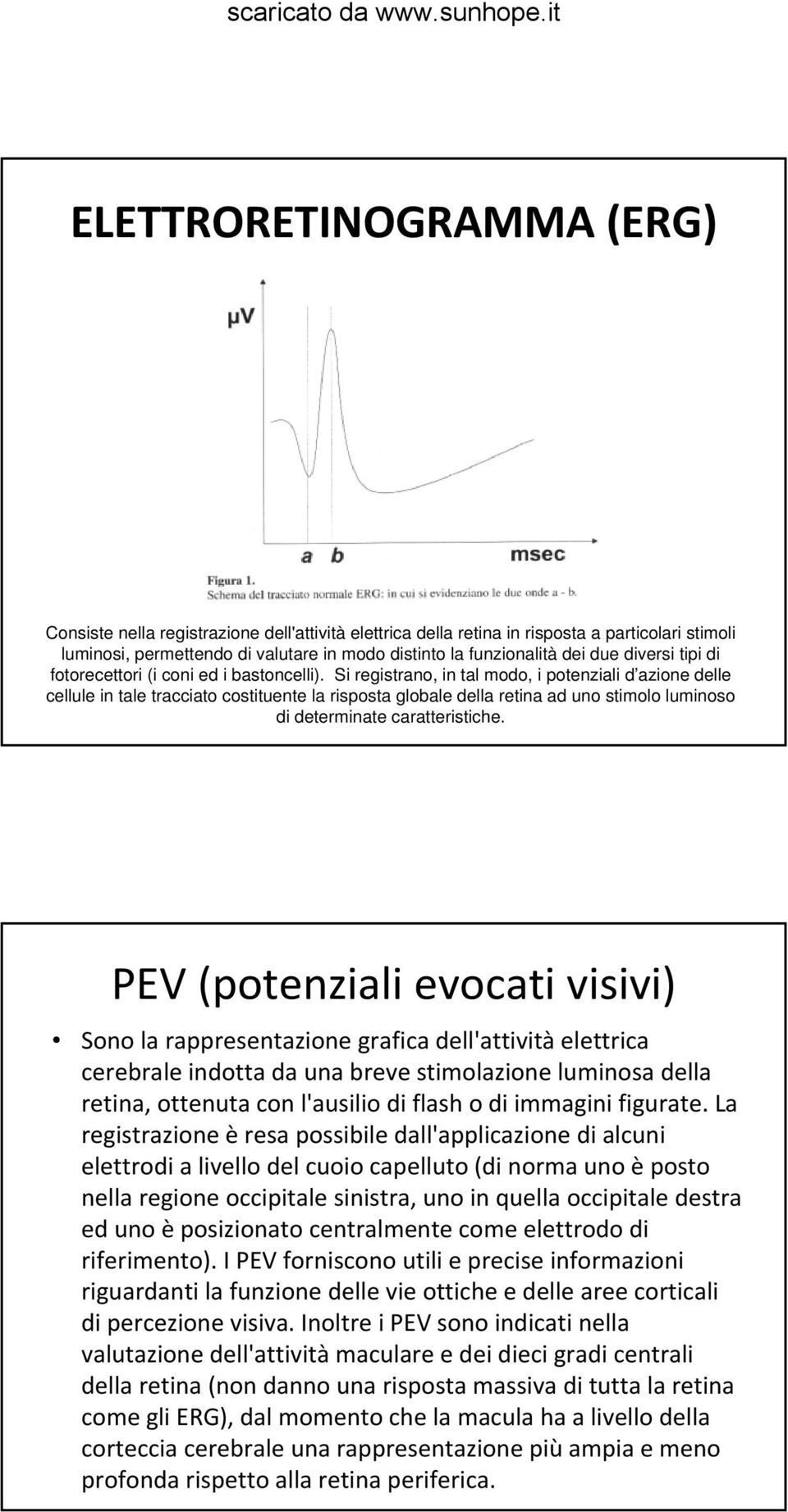 Si registrano, in tal modo, i potenziali d azione delle cellule in tale tracciato costituente la risposta globale della retina ad uno stimolo luminoso di determinate caratteristiche.