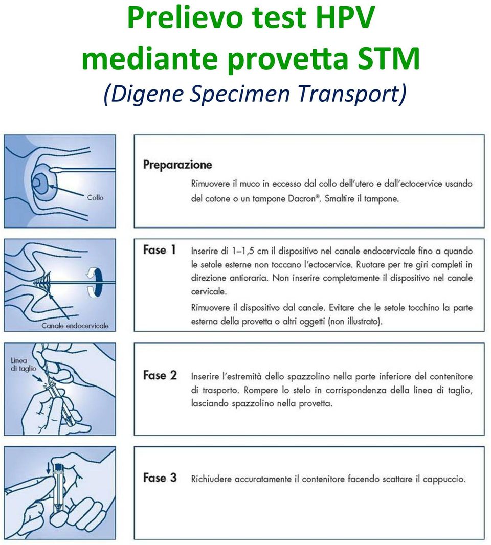 prove>a STM
