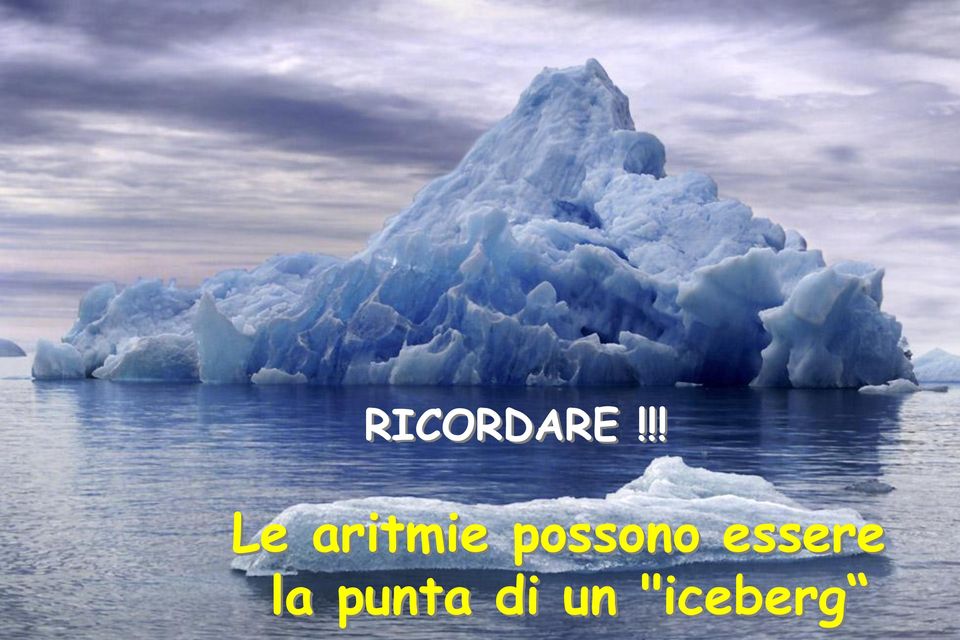 Dreifuss) Malattie d'accumulo (Glicogenosi e malattia di Fabry, in primis) Lupus materno (può essere causa di BAV congenito) Infezioni (miocarditi, endocarditi RICORDARE batteriche, RAA,!