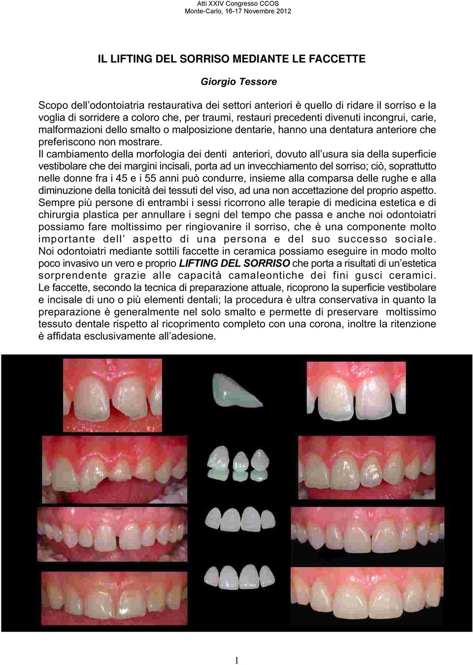 Il cambiamento della morfologia dei denti anteriori, dovuto all usura sia della superficie vestibolare che dei margini incisali, porta ad un invecchiamento del sorriso; ciò, soprattutto nelle donne