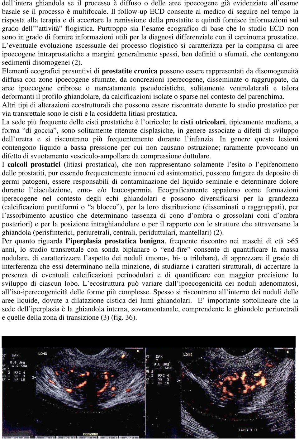 Purtroppo sia l esame ecografico di base che lo studio ECD non sono in grado di fornire informazioni utili per la diagnosi differenziale con il carcinoma prostatico.