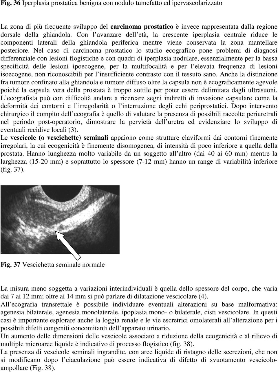 Nel caso di carcinoma prostatico lo studio ecografico pone problemi di diagnosi differenziale con lesioni flogistiche e con quadri di iperplasia nodulare, essenzialmente per la bassa specificità