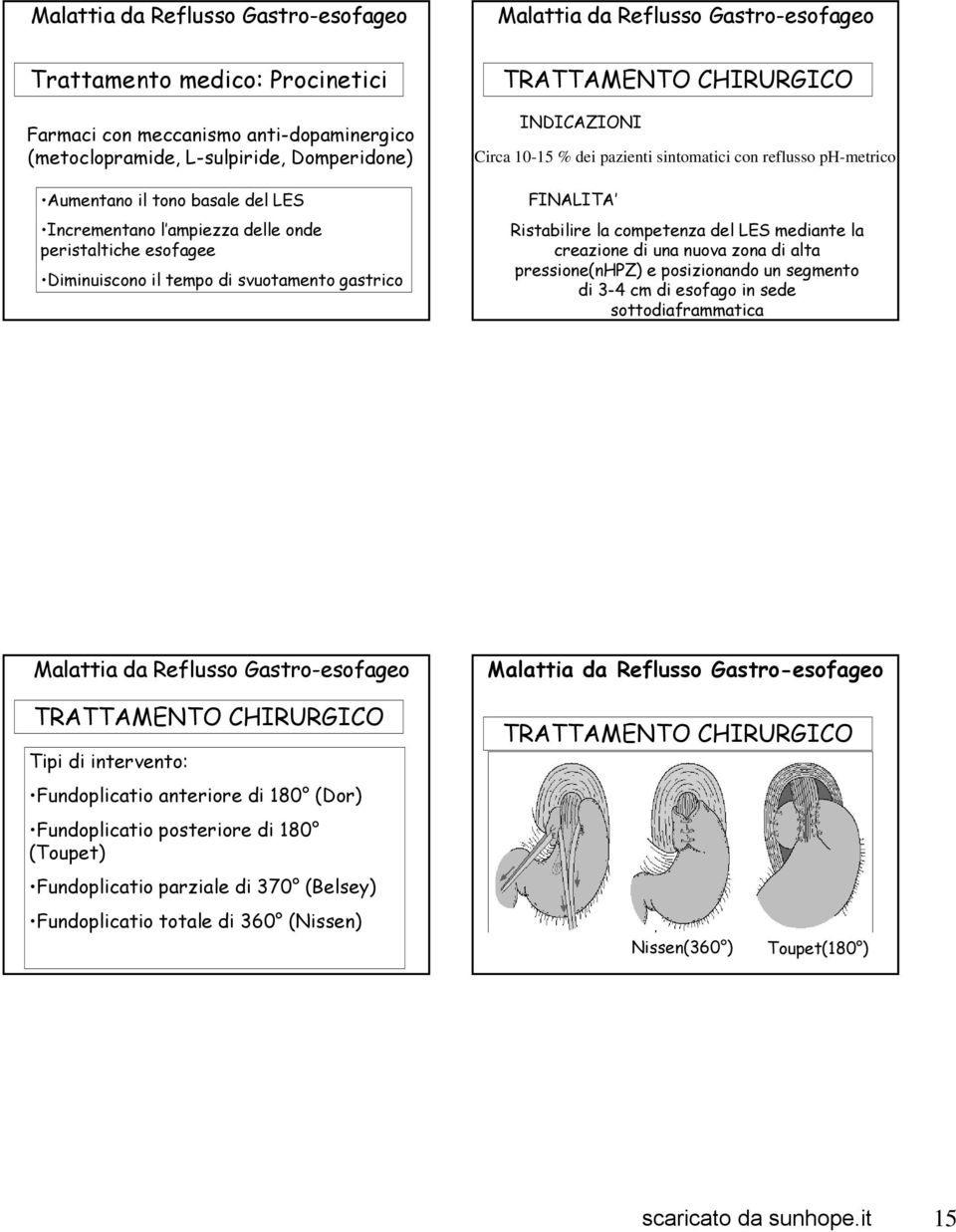 competenza del LES mediante la creazione di una nuova zona di alta pressione(nhpz) e posizionando un segmento di 3-4 cm di esofago in sede sottodiaframmatica TRATTAMENTO CHIRURGICO Tipi di