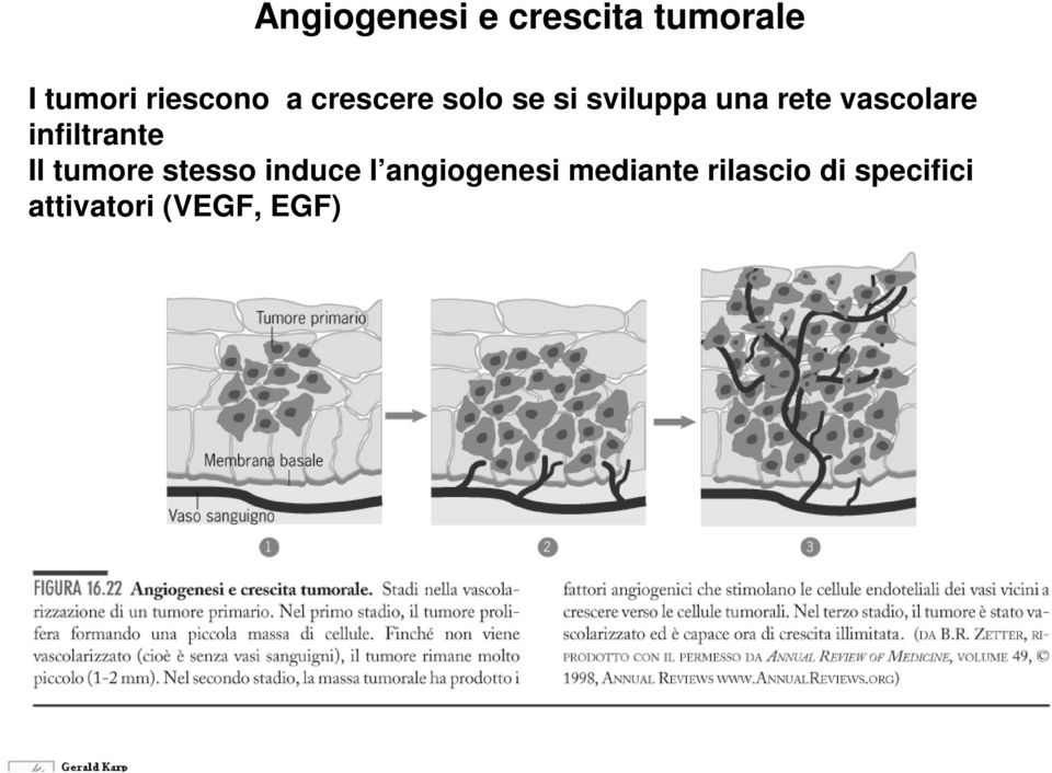 infiltrante Il tumore stesso induce l angiogenesi