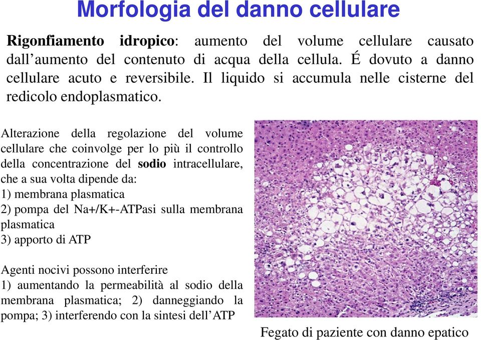 Alterazione della regolazione del volume cellulare che coinvolge per lo più il controllo della concentrazione del sodio intracellulare, che a sua volta dipende da: 1) membrana