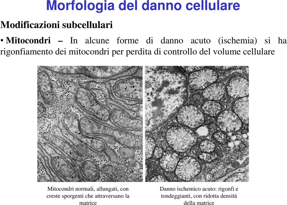volume cellulare Mitocondri normali, allungati, con creste sporgenti che attraversano la