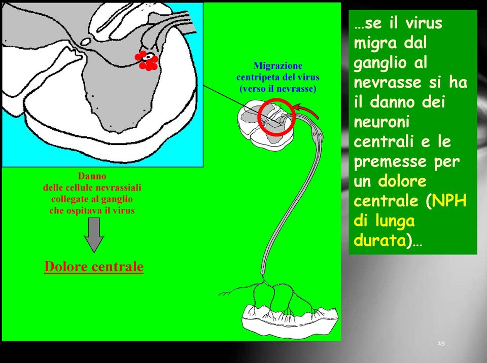 neuroni centrali e le premesse