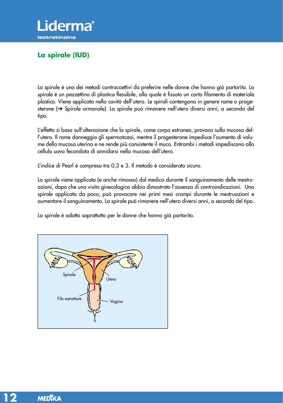 Le spirali contengono in genere rame o progesterone ( Spirale ormonale). La spirale può rimanere nell utero diversi anni, a seconda del tipo.