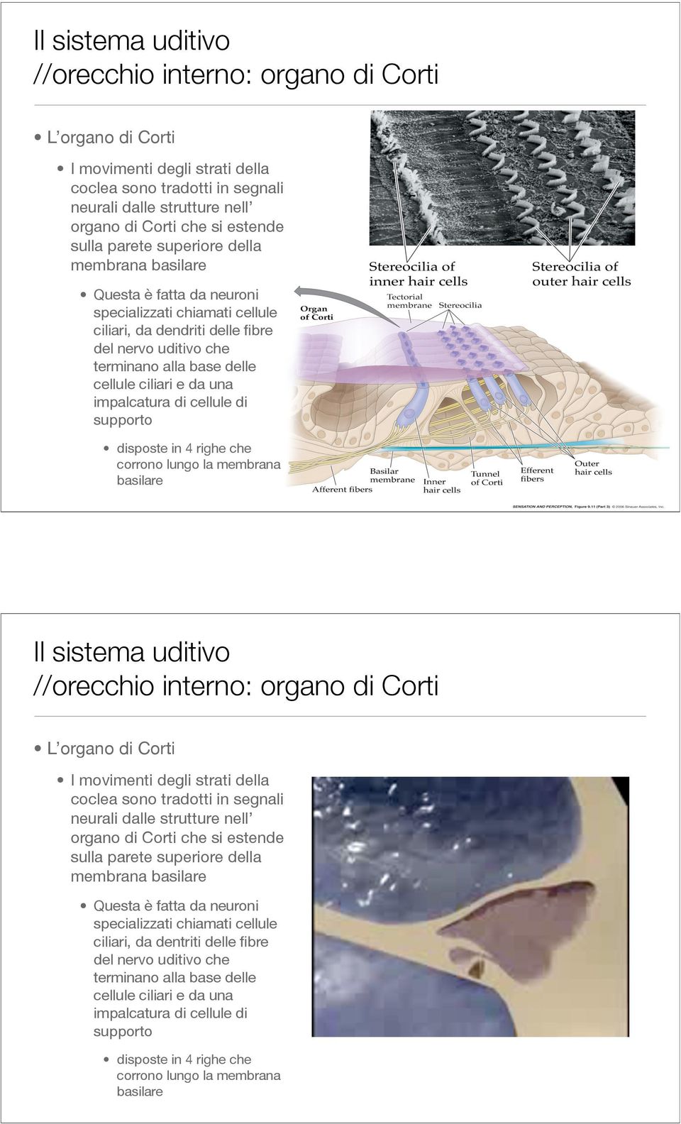 di cellule di supporto disposte in 4 righe che corrono lungo la membrana basilare  della membrana basilare Questa è fatta da neuroni specializzati chiamati cellule ciliari, da dentriti delle fibre