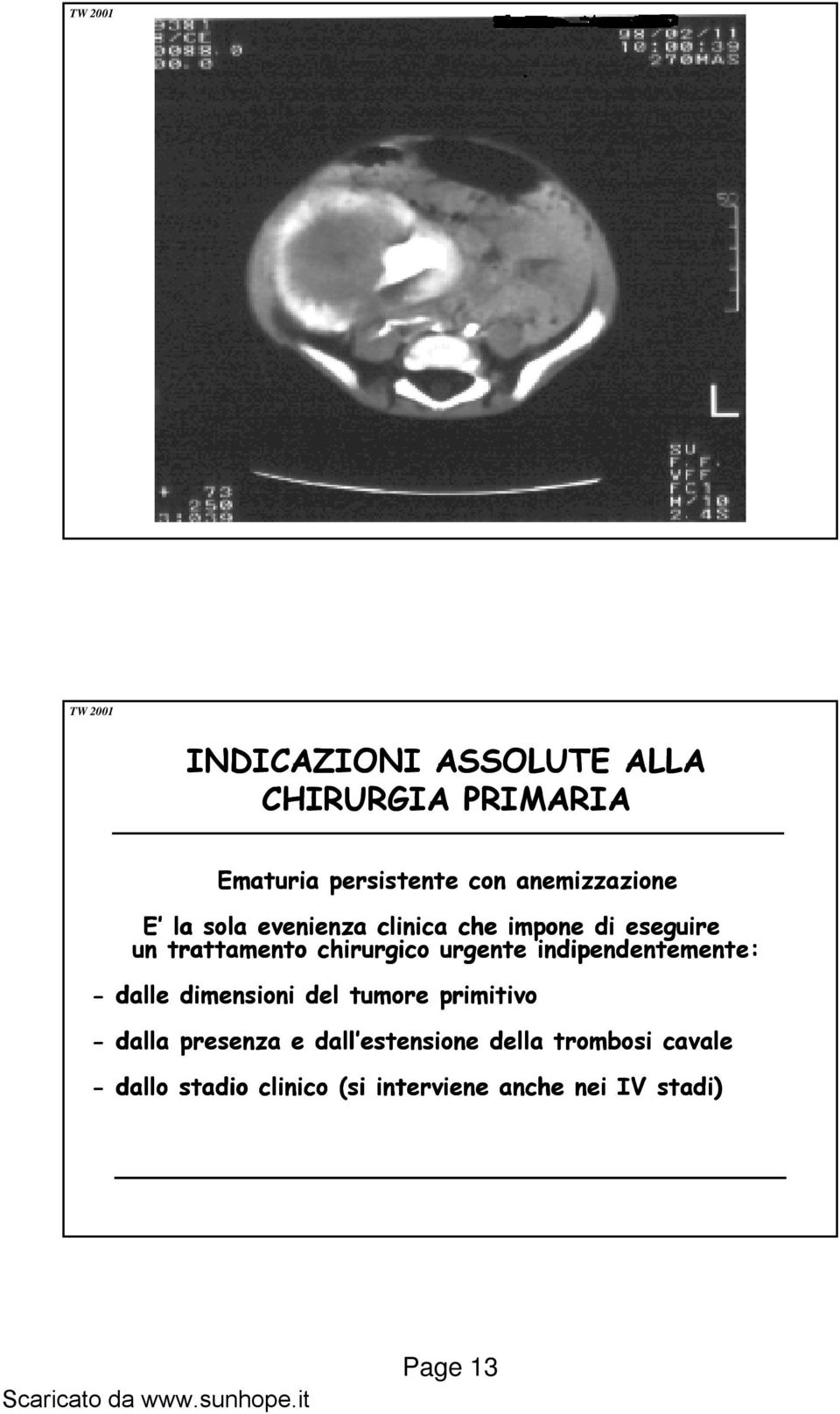 indipendentemente: - dalle dimensioni del tumore primitivo - dalla presenza e dall