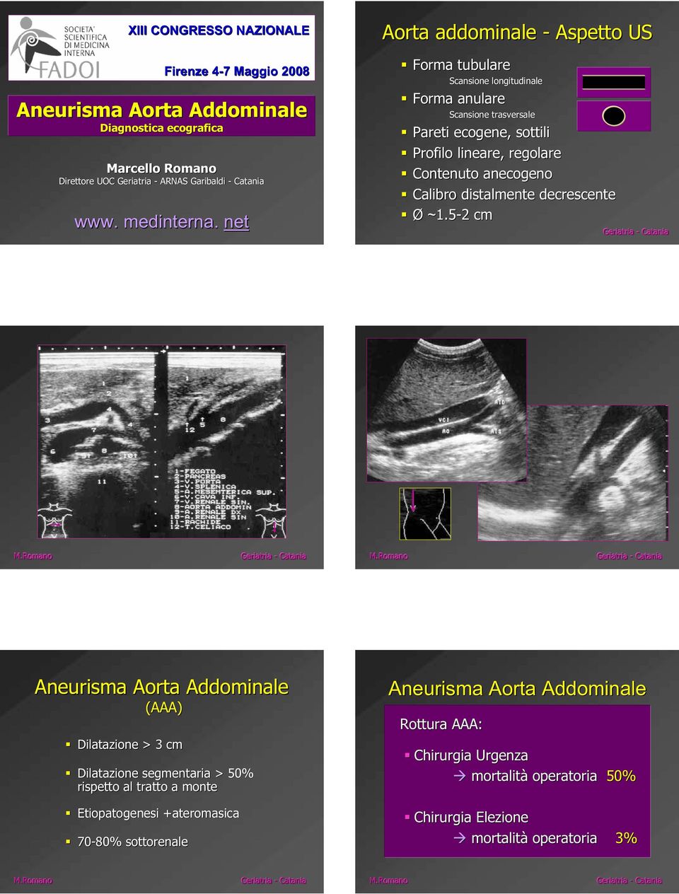 net Aorta addominale - Aspetto US Forma tubulare Scansione longitudinale Forma anulare Scansione trasversale Pareti ecogene,, sottili Profilo lineare,