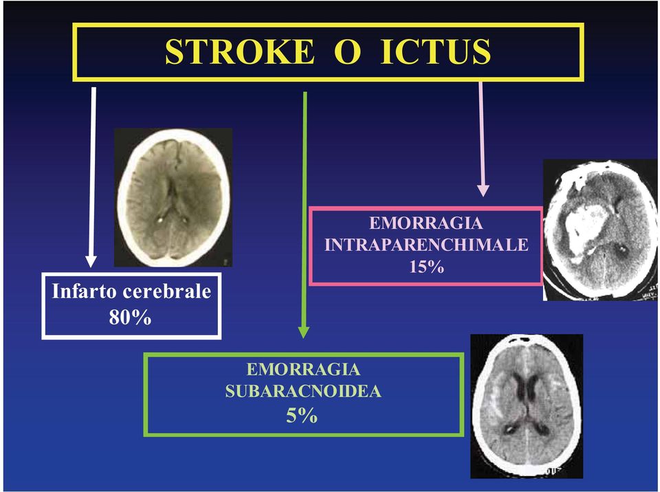 INTRAPARENCHIMALE 15%