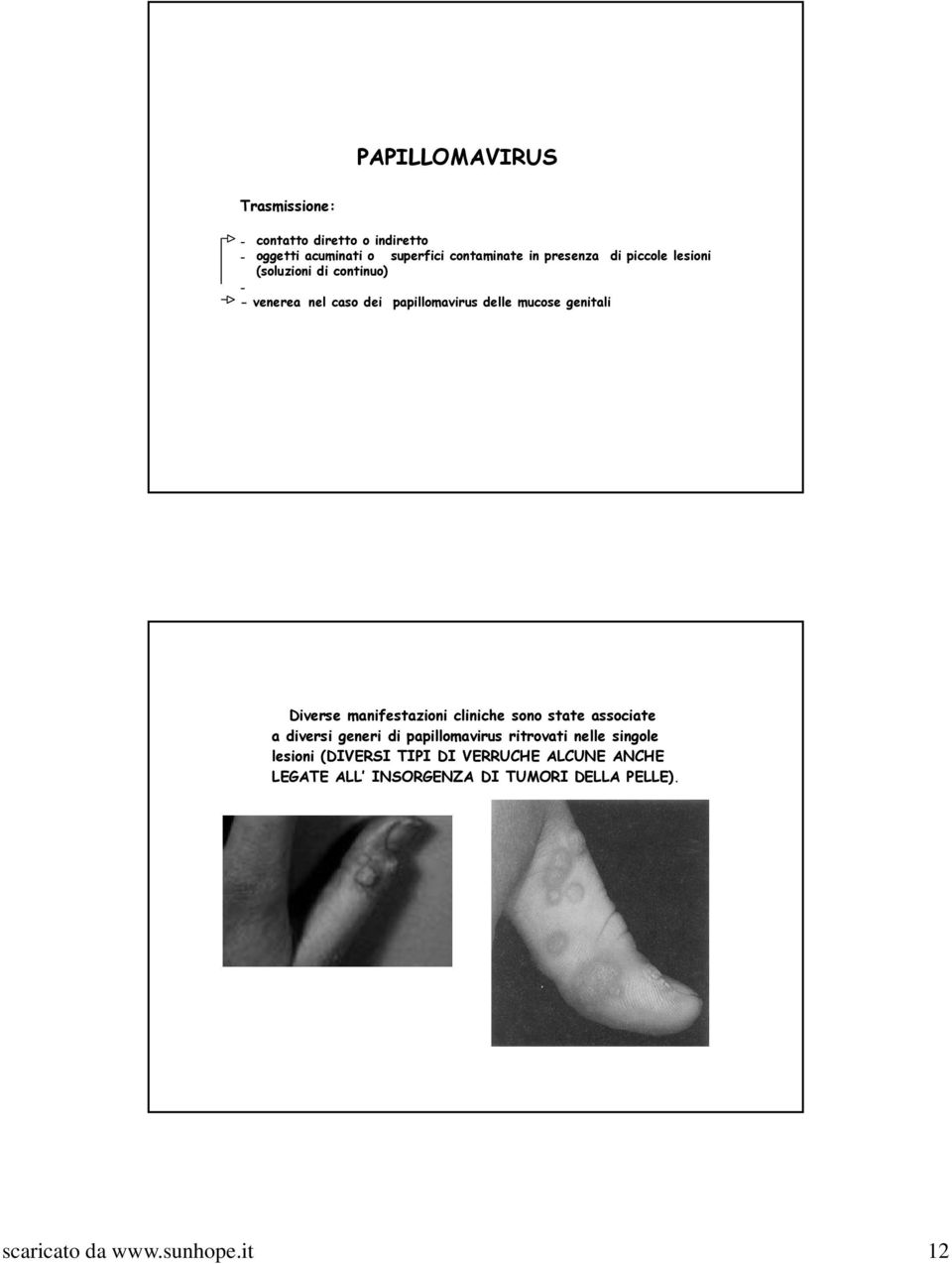 Diverse manifestazioni cliniche sono state associate a diversi generi di papillomavirus ritrovati nelle singole