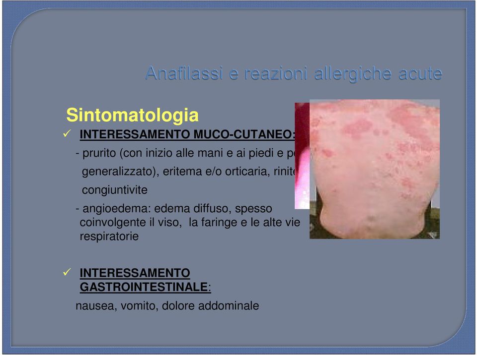 angioedema: edema diffuso, spesso coinvolgente il viso, la faringe e le alte