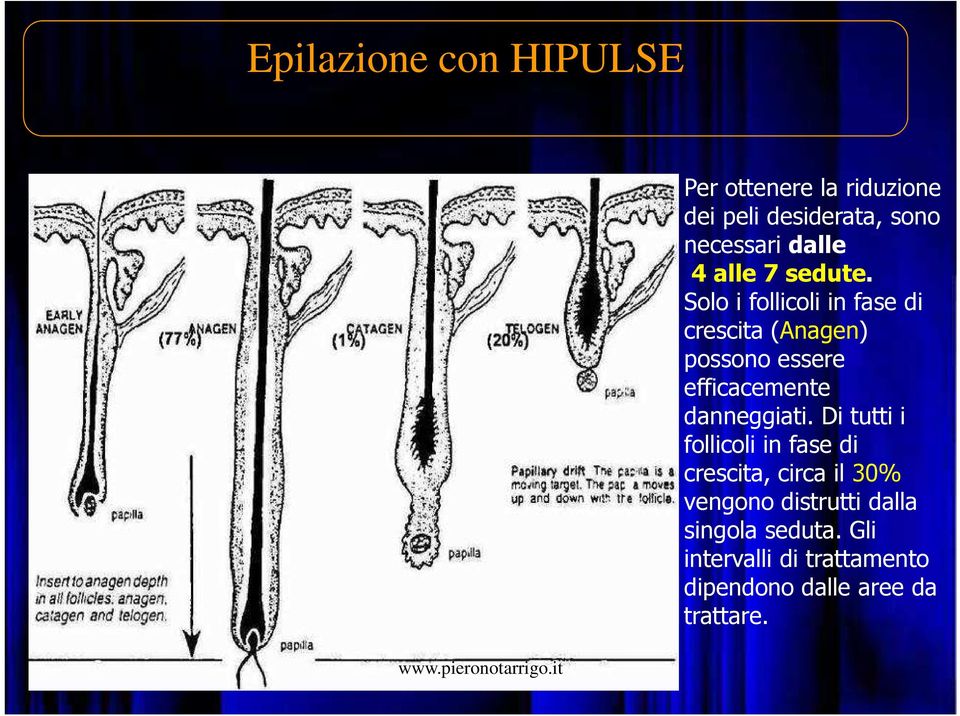 Solo i follicoli in fase di crescita (Anagen) possono essere efficacemente danneggiati.